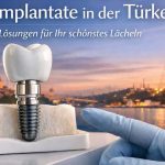 Zahnimplantat mit Keramikkrone und Titanimplantat im Kiefermodell vor der Skyline von Istanbul als Symbol für moderne Zahnimplantate in der Türkei.