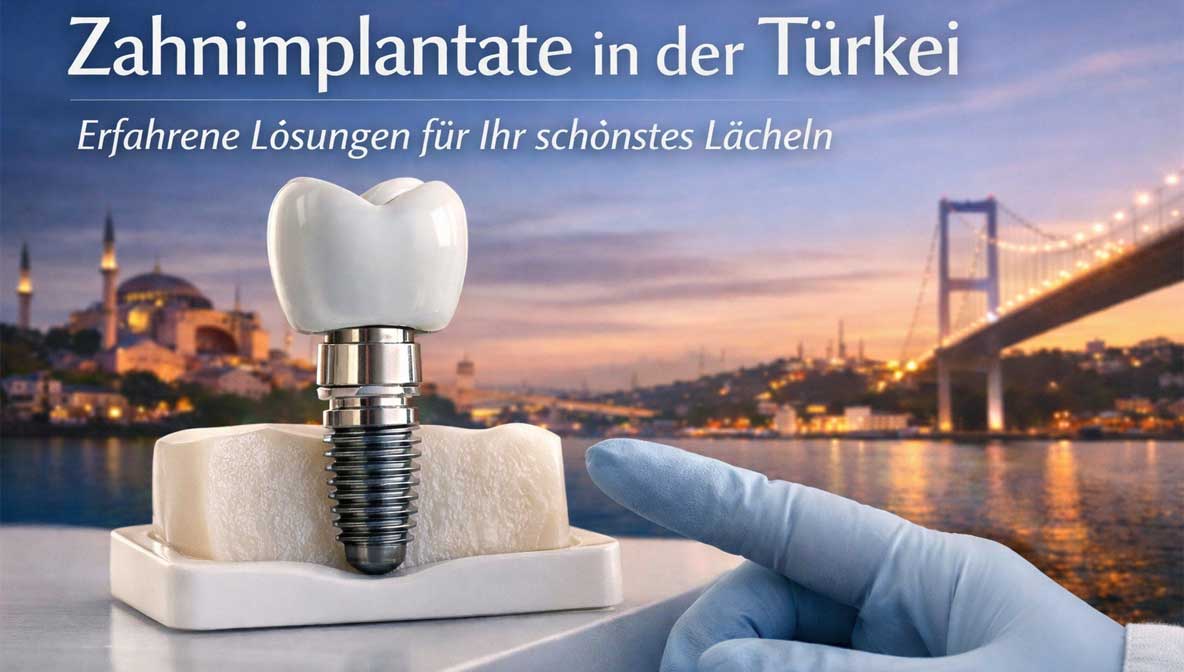 Zahnimplantat mit Keramikkrone und Titanimplantat im Kiefermodell vor der Skyline von Istanbul als Symbol für moderne Zahnimplantate in der Türkei.