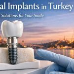 Dental implant model with a ceramic crown and titanium implant placed in bone, symbolizing advanced dental implant treatment in Turkey with Istanbul skyline in the background.